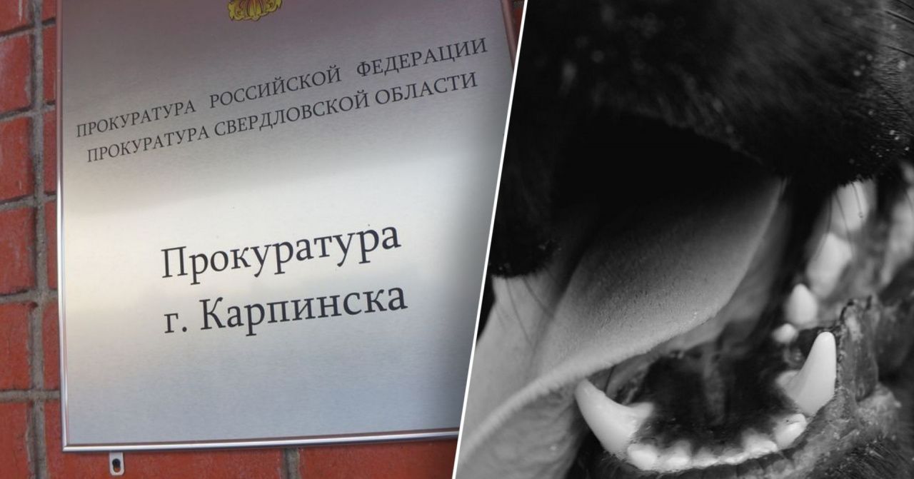 Мэрия выплатила пострадавшей от нападения собаки девочке 15 тысяч рублей
