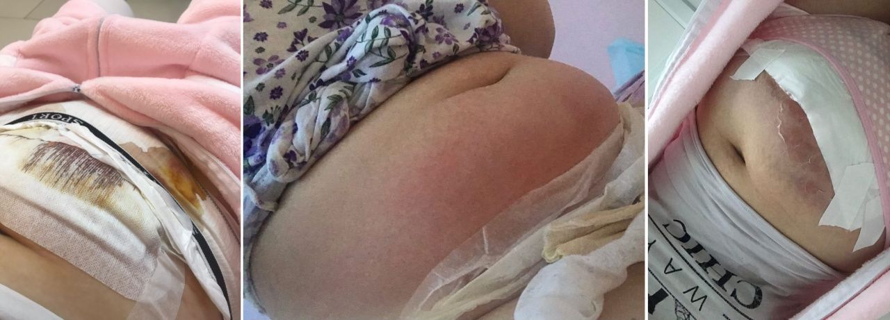 Жительница Карпинска почти месяц лечилась после родов в Краснотурьинском роддоме