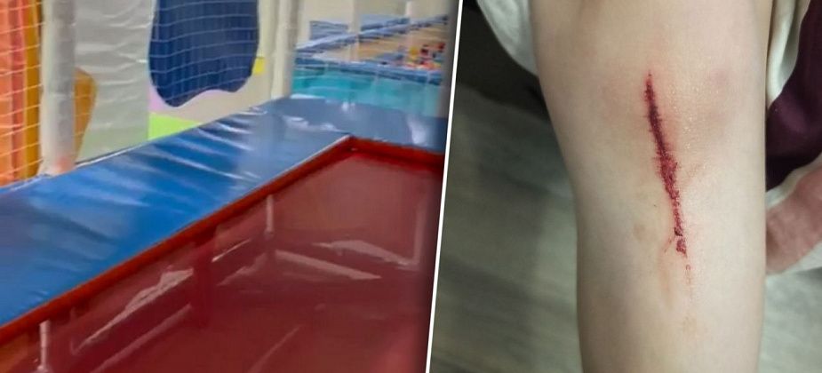 В Карпинске мать пожаловалась на травму сына в игровой комнате. Руководство заведения отреагировало