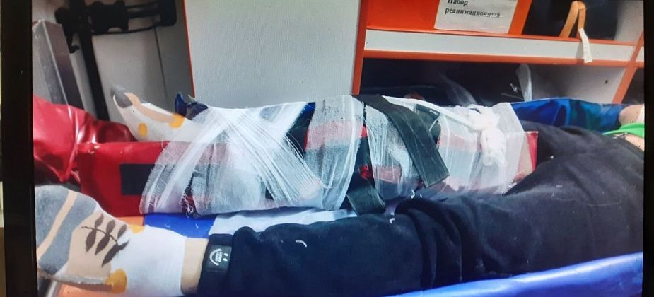 Три девицы и балкон. Версии участников конфликта, после которого женщина упала с третьего этажа
