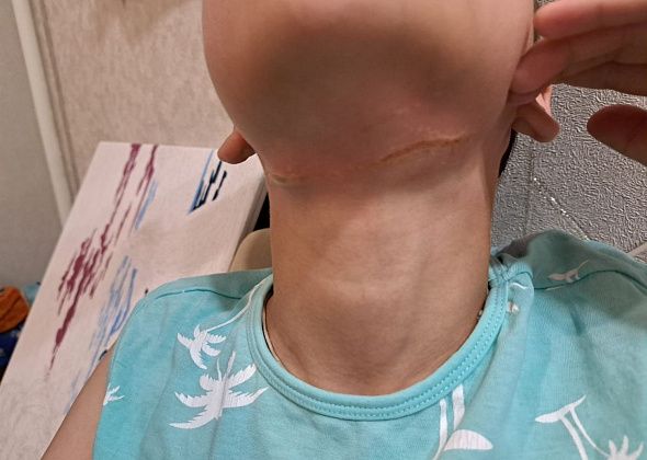 В Карпинске свисающие с дома провода травмировали 11-летнего ребенка