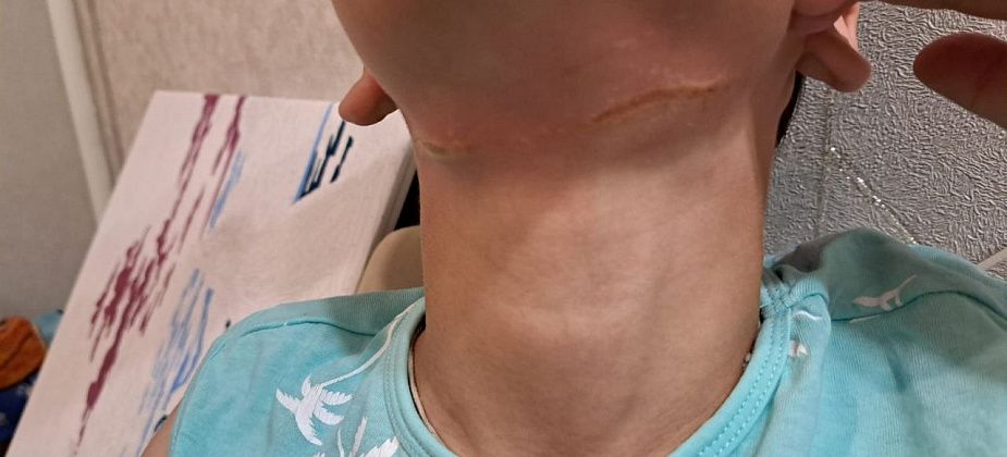 В Карпинске свисающие с дома провода травмировали 11-летнего ребенка